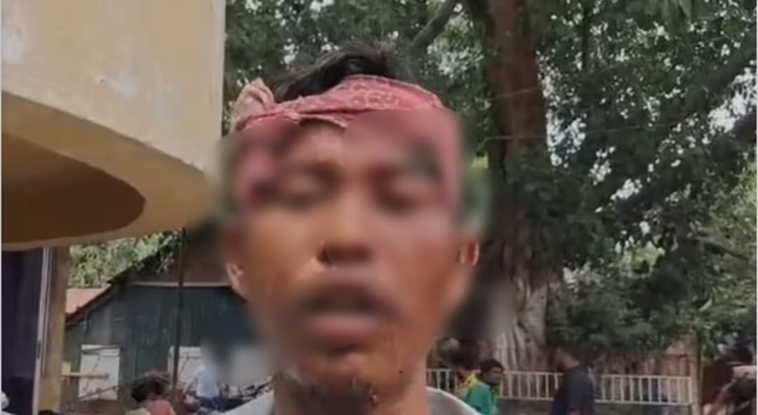 Youth Attack In Guwahati