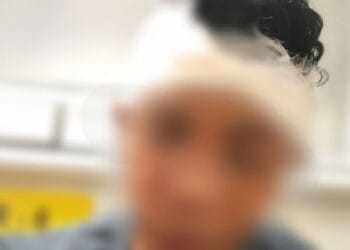 14-year-old boy found unconscious after alleged Shillong assault